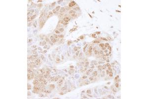 Immunohistochemistry (IHC) image for anti-Forkhead Box K2 (FOXK2) (AA 600-635) antibody (ABIN7454777)