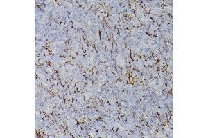 Immunohistochemistry of paraffin-embedded rat spleen using PDGFRA Rabbit pAb (ABIN3022920, ABIN3022921, ABIN3022922 and ABIN6219298) at dilution of 1:50 (40x lens).