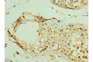 Immunohistochemistry of paraffin-embedded human testis tissue using ABIN7159289 at dilution of 1:100 (MAGEC2 anticorps  (AA 1-150))