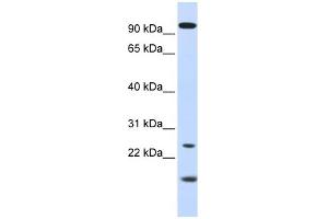 WB Suggested Anti-GUCA1A Antibody Titration: 0. (GCAP1 anticorps  (N-Term))