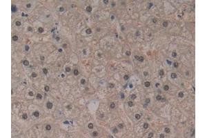 Detection of SDH in Human Liver Tissue using Polyclonal Antibody to Sorbitol Dehydrogenase (SDH)