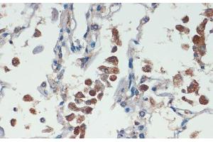 Immunohistochemistry of paraffin-embedded Human lung using APC Polyclonal Antibody at dilution of 1:200 (40x lens).
