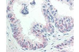 Immunohistochemistry of Mouse anti-AKT pS473 antibody.