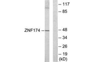 Western Blotting (WB) image for anti-Zinc Finger Protein 174 (ZNF174) (AA 201-250) antibody (ABIN2889615) (ZNF174 anticorps  (AA 201-250))