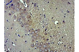 Paraformaldehyde-fixed, paraffin embedded rat brain; Antigen retrieval by boiling in sodium citrate buffer (pH6.