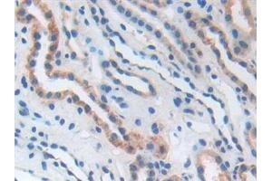 Detection of CD276 in Human Kidney Tissue using Polyclonal Antibody to Cluster Of Differentiation 276 (CD276)