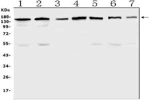 Western blot analysis of PER3 using anti-PER3 antibody (ABIN5692919).