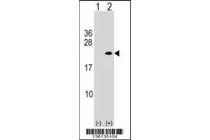 Western blot analysis of PLA2G12A using rabbit polyclonal PLA2G12A Antibody using 293 cell lysates (2 ug/lane) either nontransfected (Lane 1) or transiently transfected (Lane 2) with the PLA2G12A gene. (PLA2G12A anticorps  (AA 55-83))