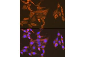 Immunofluorescence analysis of NIH-3T3 cells using USP9X Rabbit mAb (ABIN7271169) at dilution of 1:100 (40x lens). (USP9X anticorps)