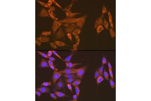 Immunofluorescence analysis of NIH-3T3 cells using USP9X Rabbit mAb (ABIN7271169) at dilution of 1:100 (40x lens). (USP9X anticorps)