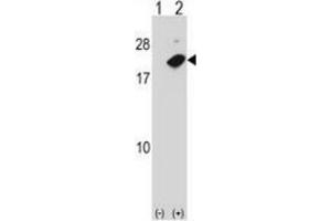 Western blot analysis of NUDT2 (arrow) using NUDT2 / APAH1 Antibody : 293 cell lysates (2 ug/lane) either nontransfected (Lane 1) or transiently transfected (Lane 2) with the NUDT2 gene. (NUDT2 anticorps  (Middle Region))
