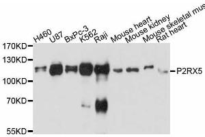 Western blot analysis of extracts of various cell lines, using P2RX5 antibody. (P2RX5 anticorps  (AA 341-422))