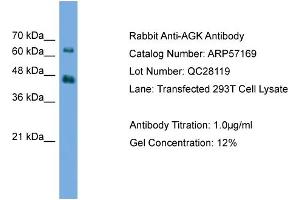 WB Suggested Anti-AGK  Antibody Titration: 0. (Acylglycerol Kinase anticorps  (N-Term))
