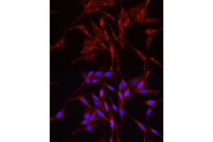Immunofluorescence analysis of PC-12 cells using TRIM4 Rabbit pAb (ABIN7270999) at dilution of 1:250 (40x lens). (TRIM4 anticorps  (AA 1-280))