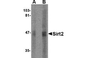 Western Blotting (WB) image for anti-Sirtuin 2 (SIRT2) (N-Term) antibody (ABIN1031568) (SIRT2 anticorps  (N-Term))