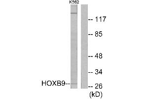 Western blot analysis of extracts from K562 cells, using HOXB9 antibody. (HOXB9 anticorps  (Internal Region))
