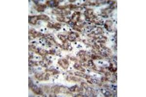Immunohistochemistry analysis in formalin fixed and paraffin embedded human liver tissue reacted with GCD / GCDH Antibody (C-term) followed by peroxidase conjugation of the secondary antibody and DAB staining. (GCDH anticorps  (C-Term))