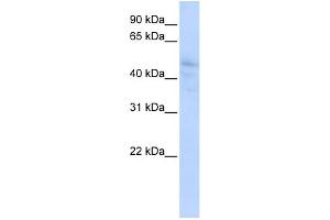 WB Suggested Anti-DLL3 Antibody Titration:  0.