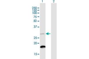 Western Blot analysis of C18orf55 expression in transfected 293T cell line ( H00029090-T01 ) by C18orf55 MaxPab polyclonal antibody. (TIMM21 anticorps  (AA 1-248))