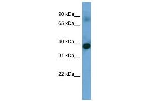 WB Suggested Anti-SFXN4 Antibody Titration: 0. (Sideroflexin 4 anticorps  (N-Term))