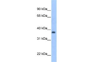 WB Suggested Anti-ST3GAL2 Antibody Titration:  0. (ST3GAL2 anticorps  (C-Term))