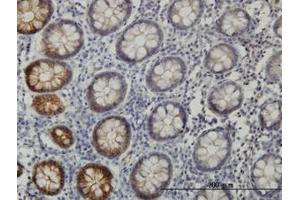 Image no. 1 for anti-EPH Receptor B3 (EPHB3) (AA 899-998) antibody (ABIN598667) (EPH Receptor B3 anticorps  (AA 899-998))