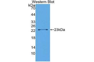 Western Blotting (WB) image for anti-Lipolysis Stimulated Lipoprotein Receptor (LSR) (AA 335-589) antibody (ABIN1176166) (LSR anticorps  (AA 335-589))