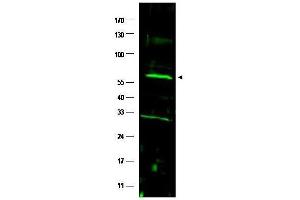 Western blot using  affinity purified anti-FANCC antibody shows detection of a band at ~63 kDa (arrowhead) corresponding to FANCC present in a HeLa whole cell lysate. (FANCC anticorps  (AA 96-112))
