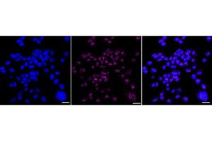 Immunocytochemical staining of HAP-1 cells with Nucleolin antibody (ABIN7799667), 1:1,000). (Recombinant Nucleolin anticorps)