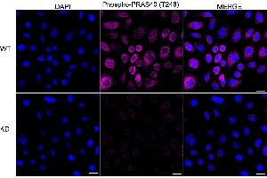 Immunocytochemical staining of HeLa cells using Phospho-PRAS40 (T246) antibody (ABIN7797545), 1:1,000), Top panel: wild-type (WT), Bottom panal: Phospho-PRAS40 (T246) shRNA knockdown (KD). (Recombinant PRAS40 anticorps  (pThr246))