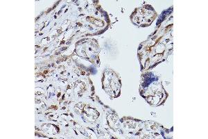 Immunohistochemistry of paraffin-embedded human placenta using PLK1 Rabbit pAb (ABIN3023351, ABIN3023352, ABIN3023353 and ABIN6219645) at dilution of 1:100 (40x lens). (PLK1 anticorps  (AA 304-603))