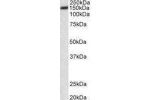 Image no. 1 for anti-ATPase, Ca++ Transporting, Plasma Membrane 1 (ATP2B1) (AA 312-327) antibody (ABIN1100135) (ATP2B1 anticorps  (AA 312-327))