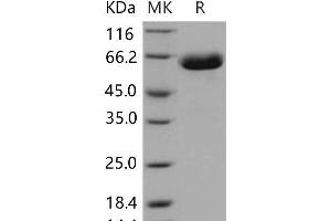 Western Blotting (WB) image for EPH Receptor B1 (EPHB1) (Active) protein (His tag) (ABIN7195545)
