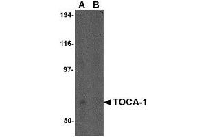 Image no. 1 for anti-Formin Binding Protein 1-Like (FNBP1L) (N-Term) antibody (ABIN1494383) (FNBP1L anticorps  (N-Term))