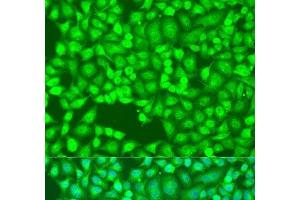 Immunofluorescence analysis of U2OS cells using FLT4 Polyclonal Antibody at dilution of 1:100. (FLT4 anticorps)