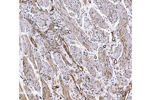 IHC analysis of COL4A3 using anti-COL4A3 antibody (ABIN7600055).