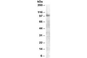 Western blot testing of A549 lysate with FGFR2 antibody at 0. (FGFR2 anticorps)