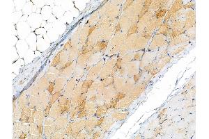 ABIN7093174 and ABIN7101256 at 1/100 staining Rat skin tissue by IHC-P. (C9 anticorps)