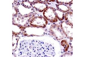 CD70 antibody immunohistochemistry analysis in formalin fixed and paraffin embedded human kidney tissue.