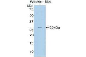 Western Blotting (WB) image for anti-Complement Factor H (CFH) (AA 975-1217) antibody (ABIN3208198) (Complement Factor H anticorps  (AA 975-1217))