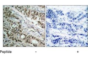 Image no. 3 for anti-Forkhead Box O1 (FOXO1) (AA 254-258) antibody (ABIN197334) (FOXO1 anticorps  (AA 254-258))