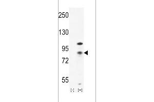 Western blot analysis of CTNB1 (arrow) using rabbit polyclonal CTNB1 Antibody (C-term) (ABIN655178 and ABIN2844795). (CTNNB1 anticorps  (C-Term))