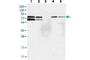 Western blot analysis of Lane 1: RT-4, Lane 2: U-251 MG, Lane 3: Human Plasma, Lane 4: Liver, Lane 5: Tonsil with SNX18 polyclonal antibody  at 1:250-1:500 dilution. (SNX18 anticorps)