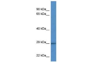 WB Suggested Anti-F11R Antibody Titration: 1. (F11R anticorps  (C-Term))
