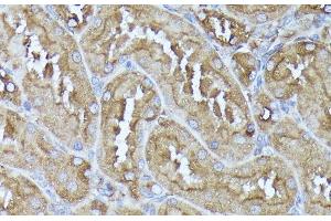 Immunohistochemistry of paraffin-embedded Rat kidney using DLAT Polyclonal Antibody at dilution of 1:100 (40x lens).