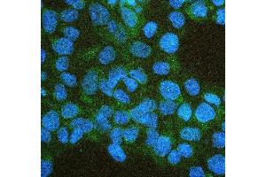 IF analysis of IFNAR2 using anti-IFNAR2 antibody (ABIN7601353). (IFNAR2 anticorps  (AA 33-466))