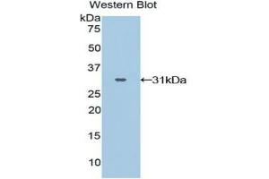 Western blot analysis of the recombinant protein. (GRAP2 anticorps  (AA 15-247))