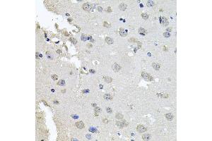 Immunohistochemistry of paraffin-embedded mouse brain using PKN1 antibody (ABIN6003498) at dilution of 1/100 (40x lens). (PKN1 anticorps)