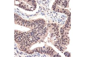 Immunohistochemistry of paraffin-embedded human colon carcinoma using EHMT2 Rabbit mAb (ABIN7265616) at dilution of 1:100 (40x lens). (EHMT2 anticorps)