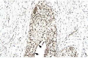 Human urinary bladder